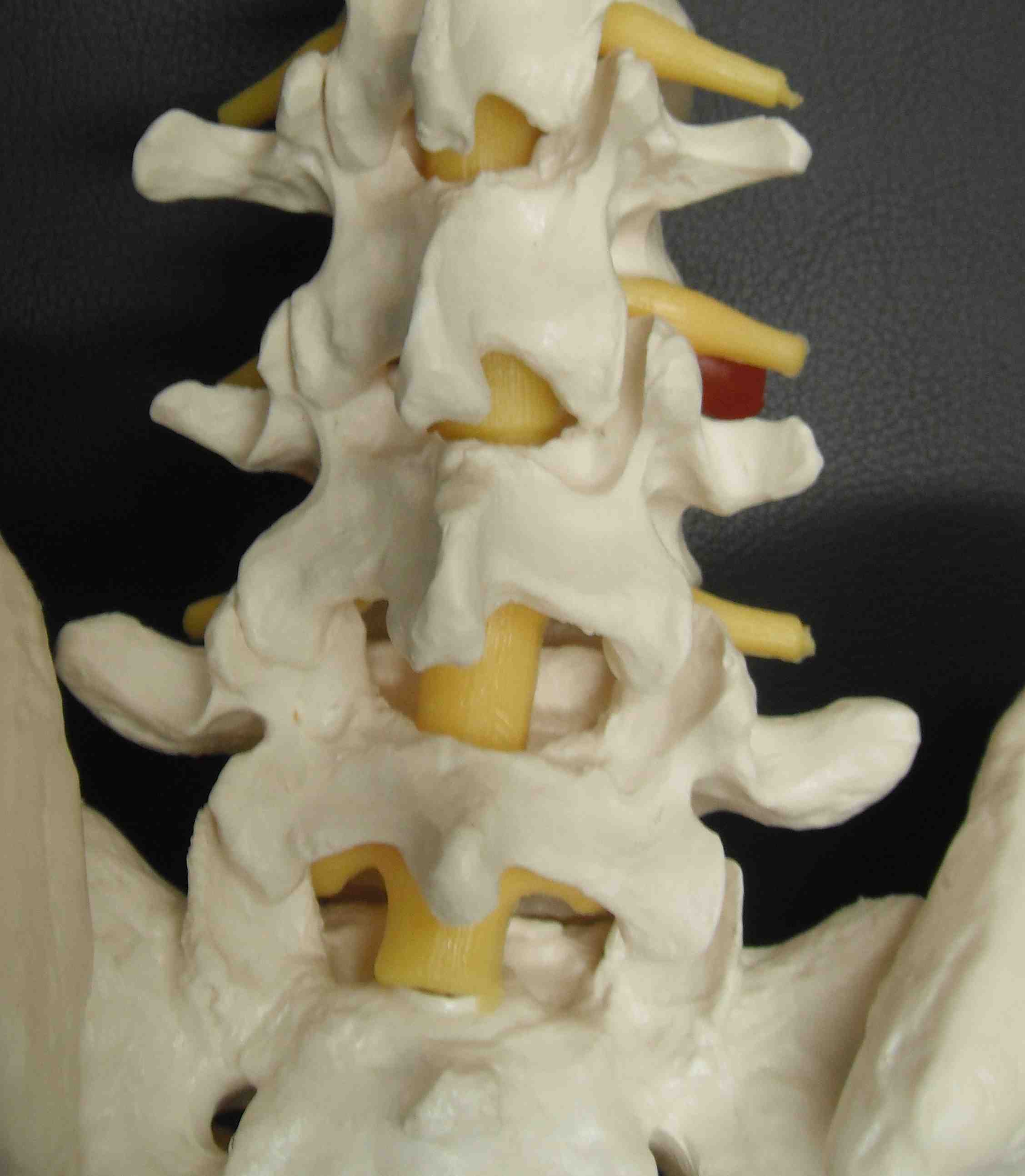 Lumbar Spine Posterior
